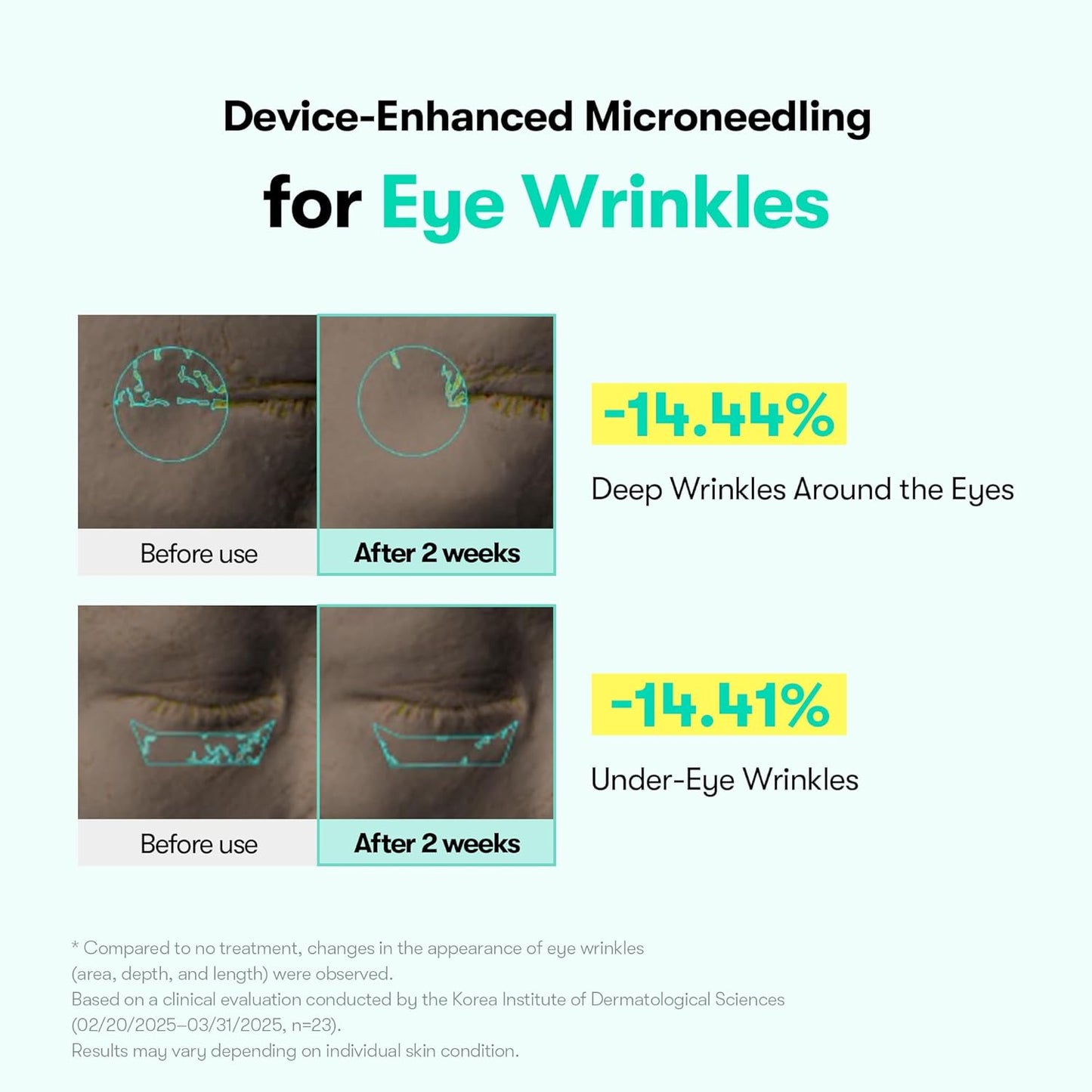 Micro-Vibration Under Eye Firming Cream